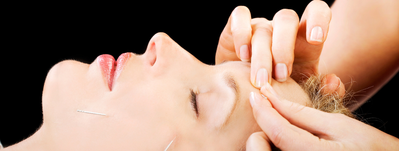 Aesthetic, Cosmetic or Facial Acupuncture?