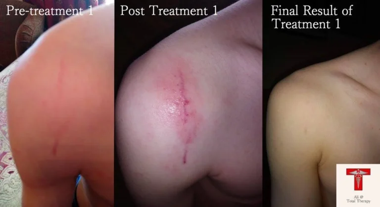 19238211 1841147169545695 6606377318212348937 o 768x420