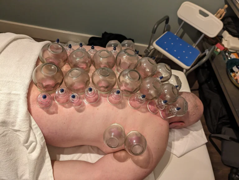 PXL 20240105 082001618.MP  768x578