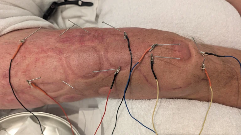 PXL 20240717 175820439 768x432