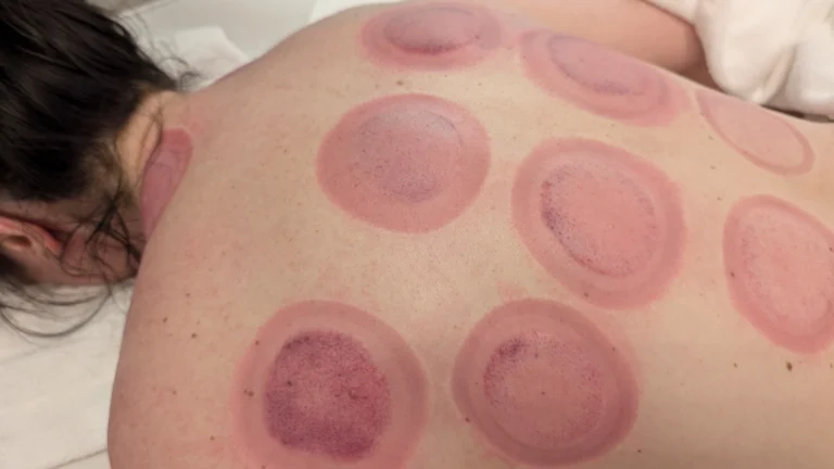 PXL 20240719 093729722 768x432