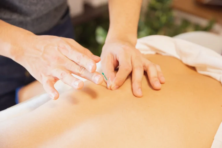 treat chronic pain with acupuncture wilmington nc scaled 1 768x512