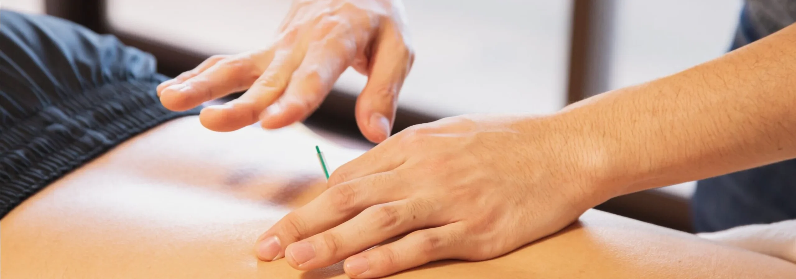 Acupuncture Association