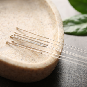Advanced Acupuncture – The Extraordinary Meridians