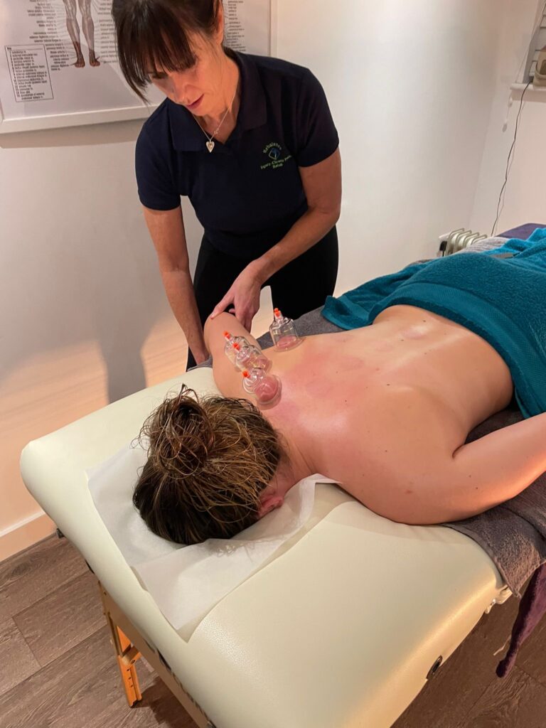 cupping 768x1024