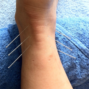 Classroom: (1 day) Musculoskeletal and Sports Injury CPD (Including Acupuncture)